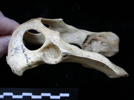 Pelvis