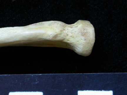 Radius : partie proximale