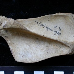 Scapula : vue latérale