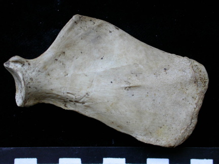 Scapula : vue médiale