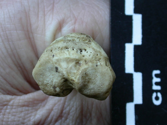 Tibia : partie proximale