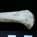  Tibia: proximale part