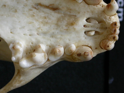 Dentition supérieure