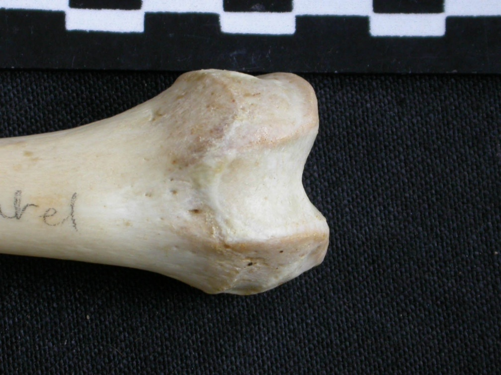 Fémur : partie distale