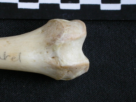 Fémur : partie distale