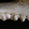 Dentition inférieure