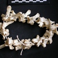 Thoracic vertebrae