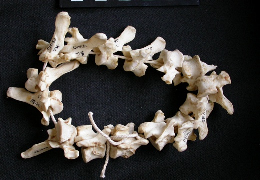 Thoracic vertebrae