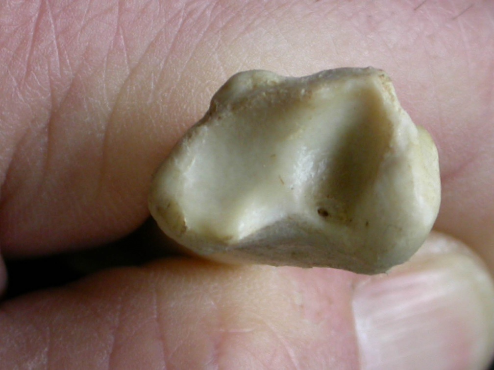 Tibia : partie distale