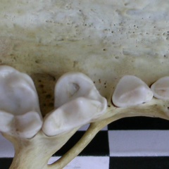 Dentition supérieure