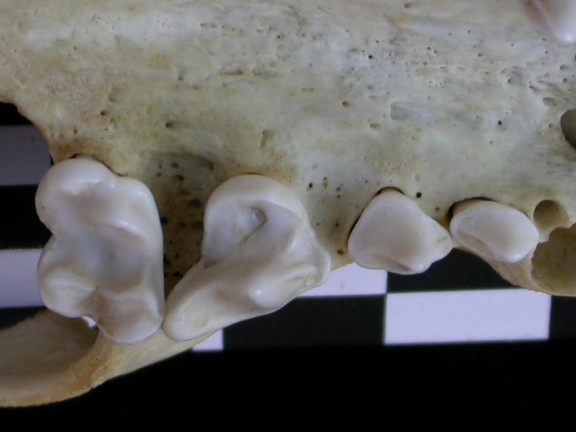 Dentition supérieure