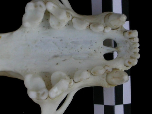 Dentition supérieure