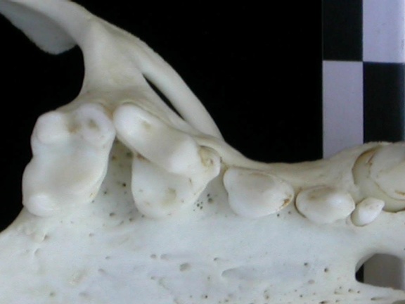 Dentition supérieure