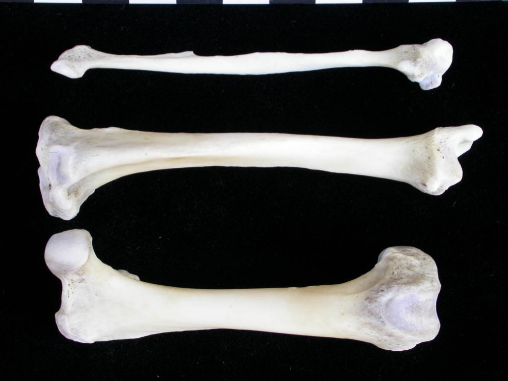 Fémur, tibia et fibula