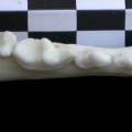 Dentition inférieure