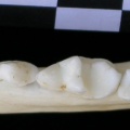 Dentition inférieure