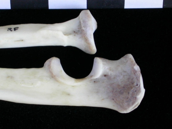 Radius and ulna: proximale part