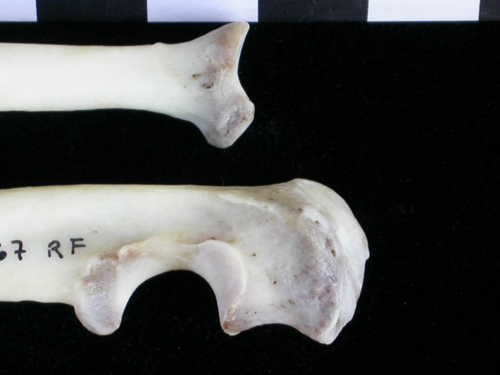 Radius et ulna : partie proximale