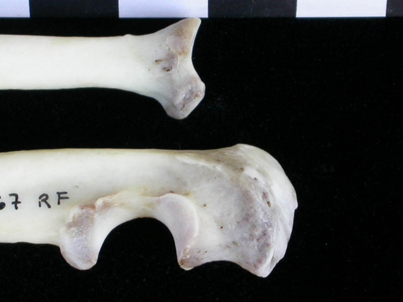 Radius et ulna : partie proximale