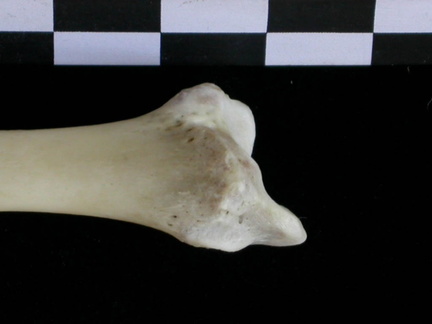  Tibia: distal part