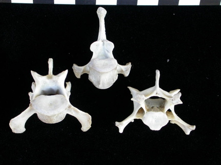 Vertebrae