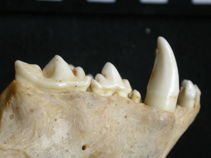 Dentition supérieure