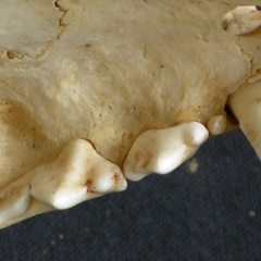 Dentition supérieure