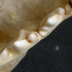 Dentition supérieure