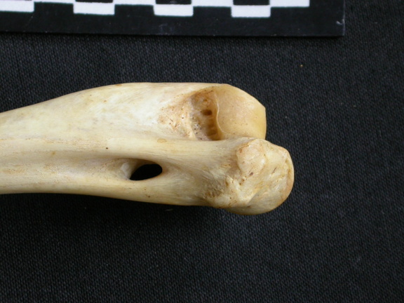 Humérus : partie distale