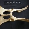 Pelvis