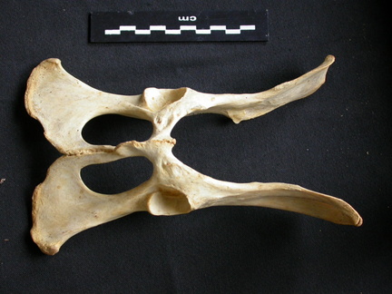 Pelvis