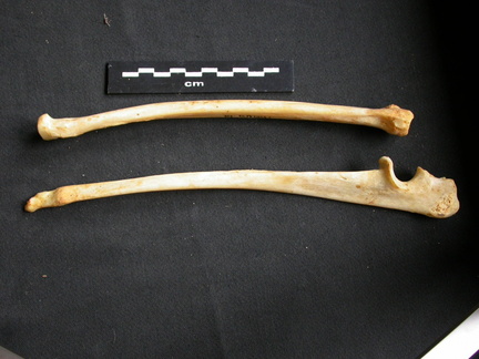 Radius et ulna