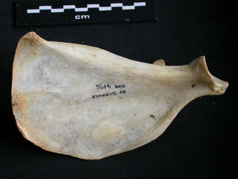 Scapula : vue médiale