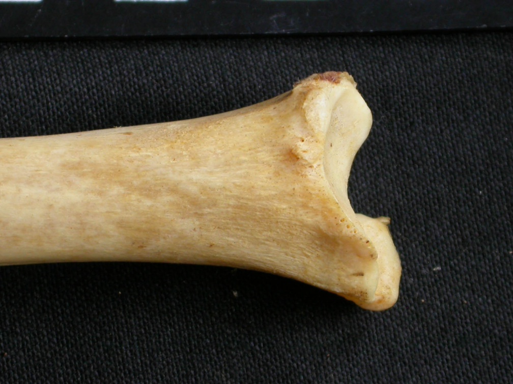  Tibia: distal part