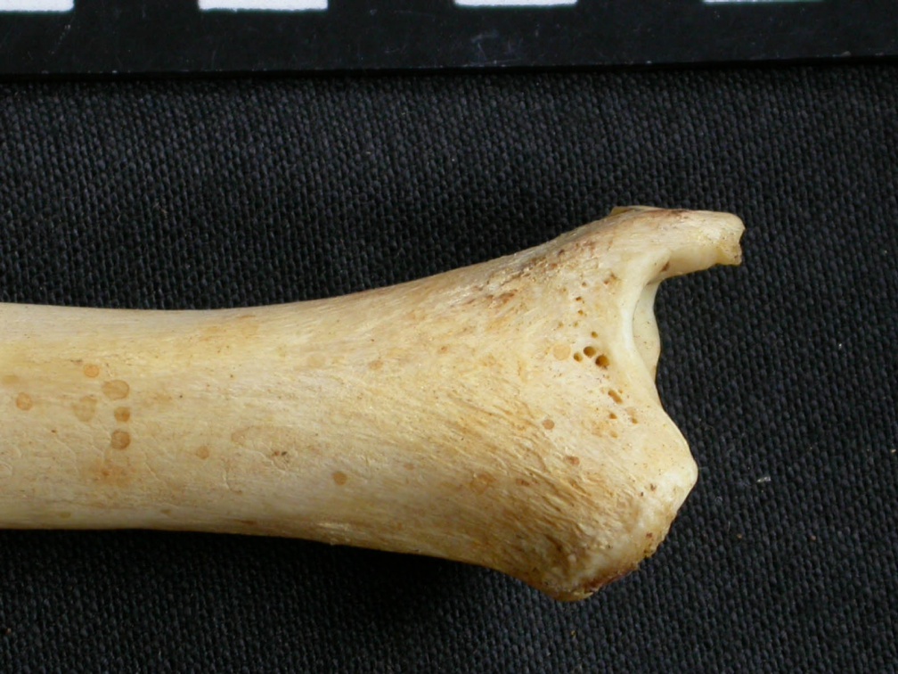  Tibia: distal part