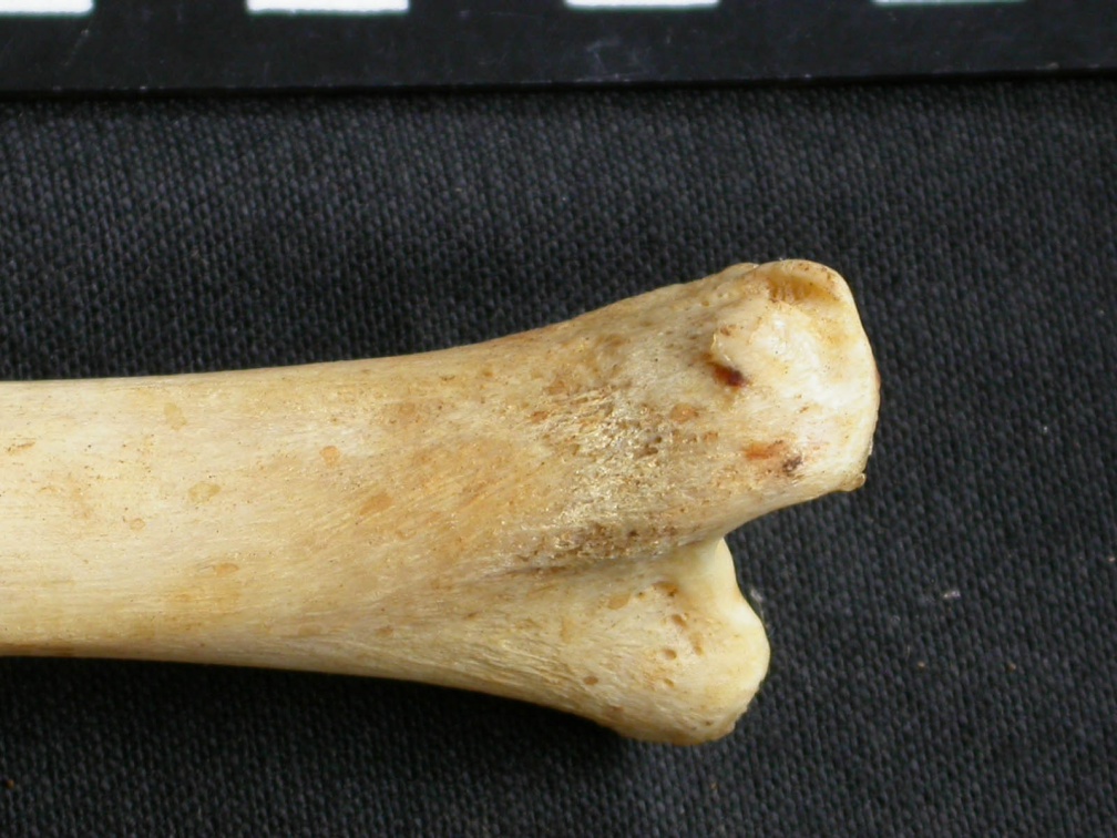  Tibia: distal part