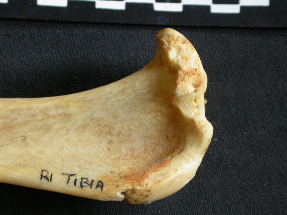 Tibia : partie proximale