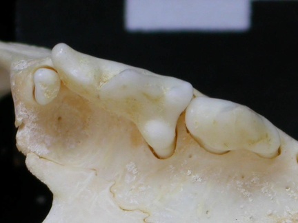 Dentition supérieure