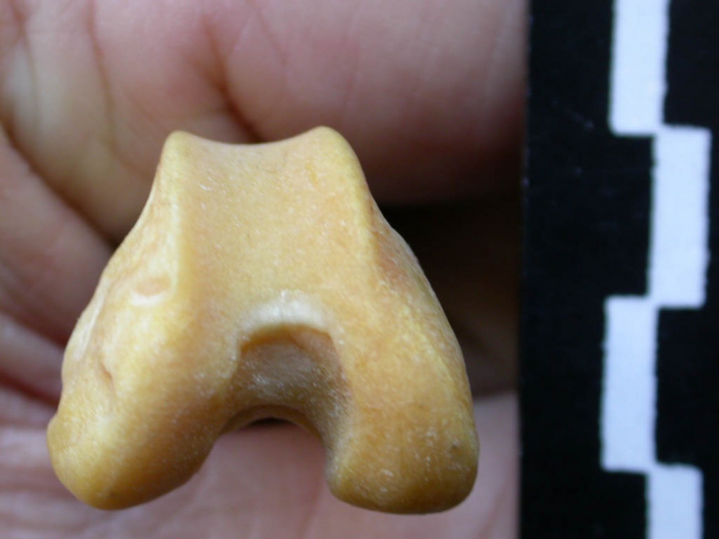 Fémur : partie distale