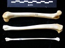 Fémur, tibia et fibula