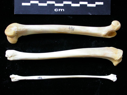 Fémur, tibia et fibula