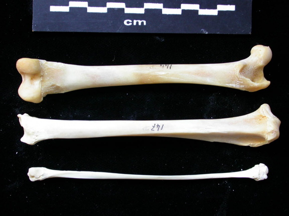 Fémur, tibia et fibula