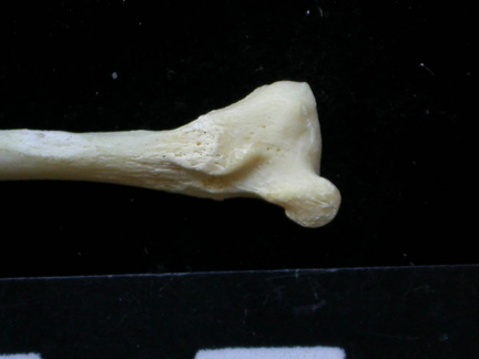 Fíbula : parte distal