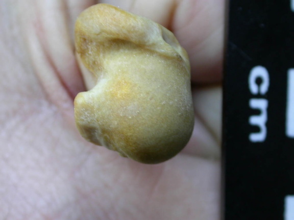 Humerus: proximal end