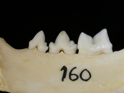 Lower teeth