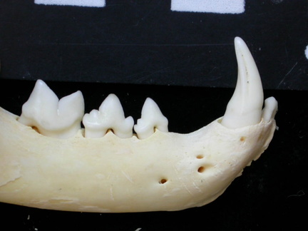 Lower teeth