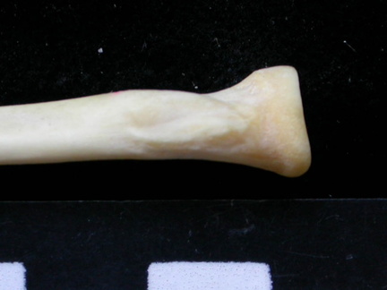 Radius: proximale part