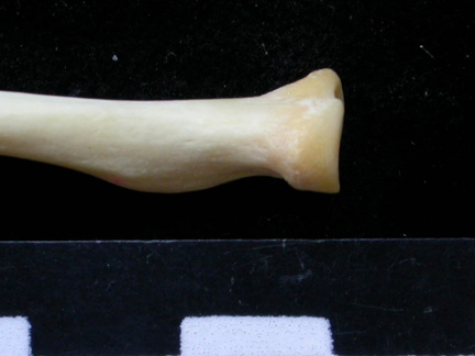 Radius: proximale part