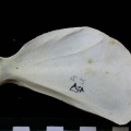 Scapula : vue médiale