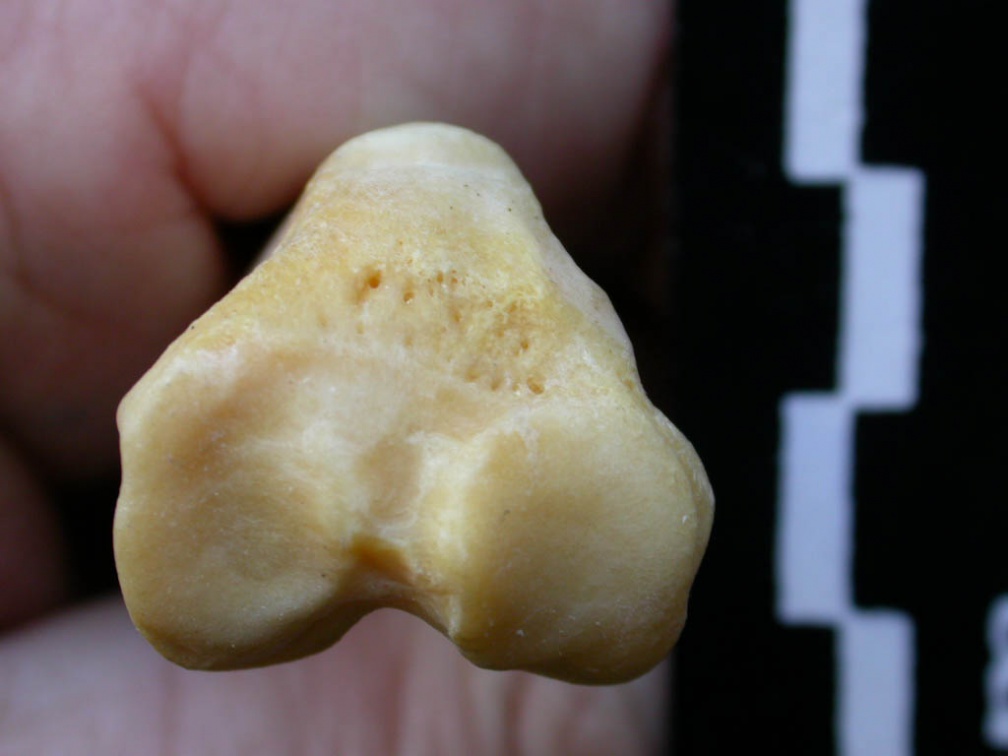 Tibia : partie proximale